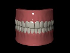 Denture 3D Model
