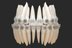 Teeth Gums 3D Model