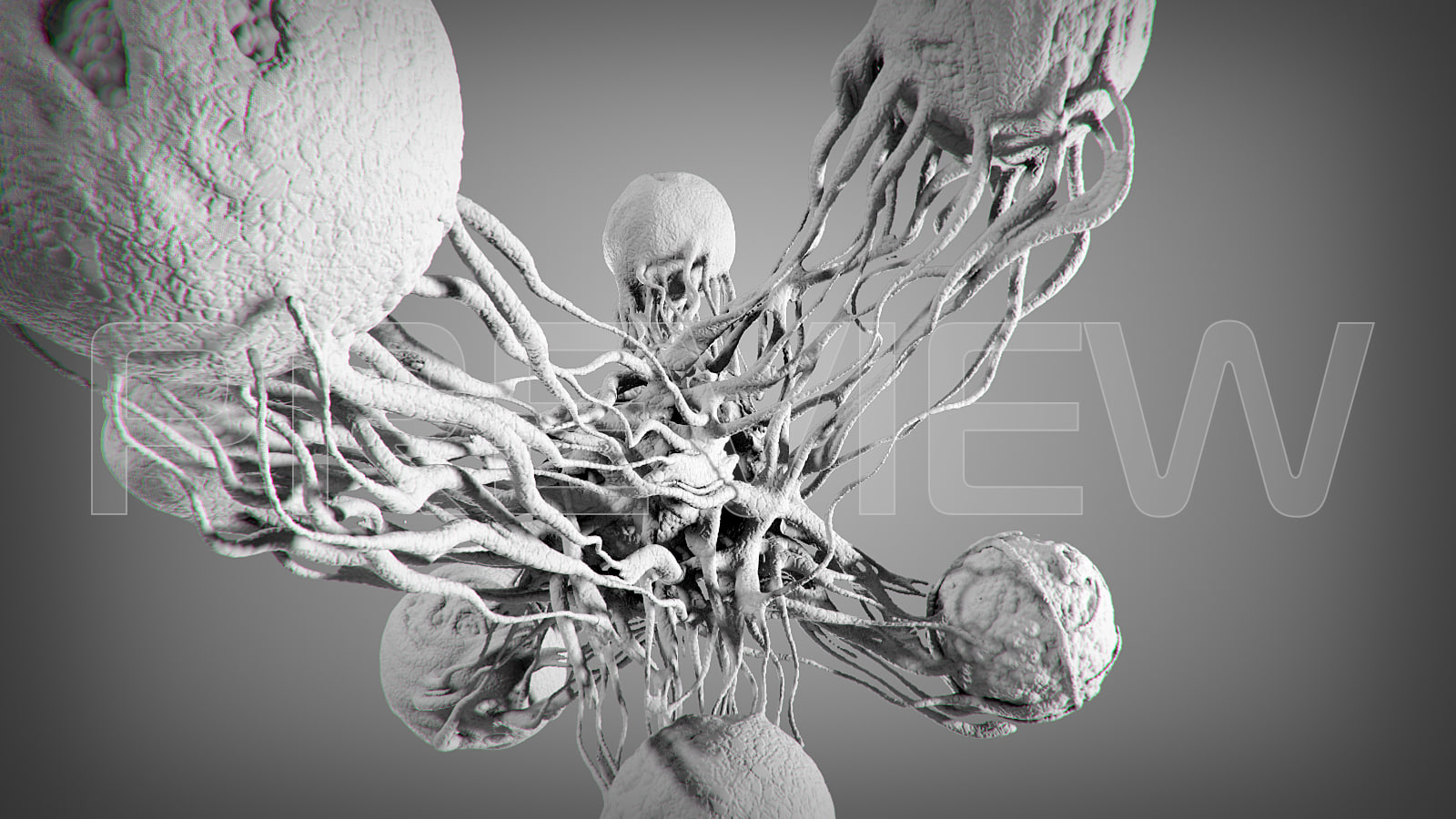 Cancer Stl Model 3D Model