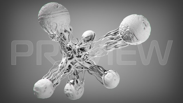 Cancer Stl Model 3D Model