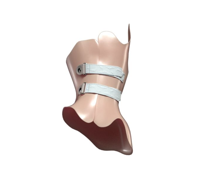 3D Corset For Scoliosis model 3D Model