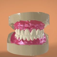 Digital Full Dentures for 3D Printing 3D Print Model