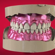 Digital Full Dentures for 3D Printing, Milling & Injection Molding 3D Print Model