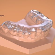 Digital Mandibular Tanner Splint 3D Print Model