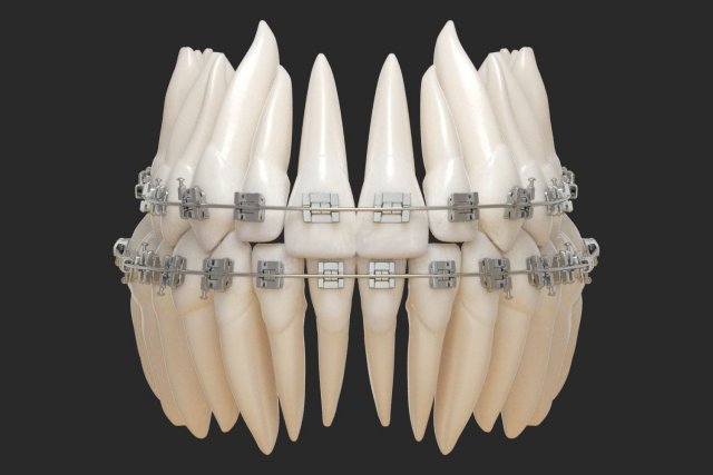 Teeth 3D Model