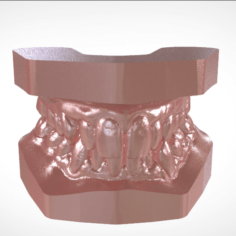 Digital Study Orthodontic Archman Model  3D Print Model