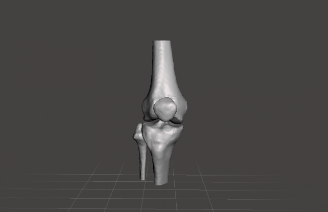 Right knee joint – female 3D Model