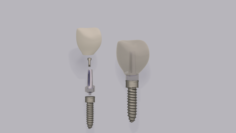Dental implant 3D Model