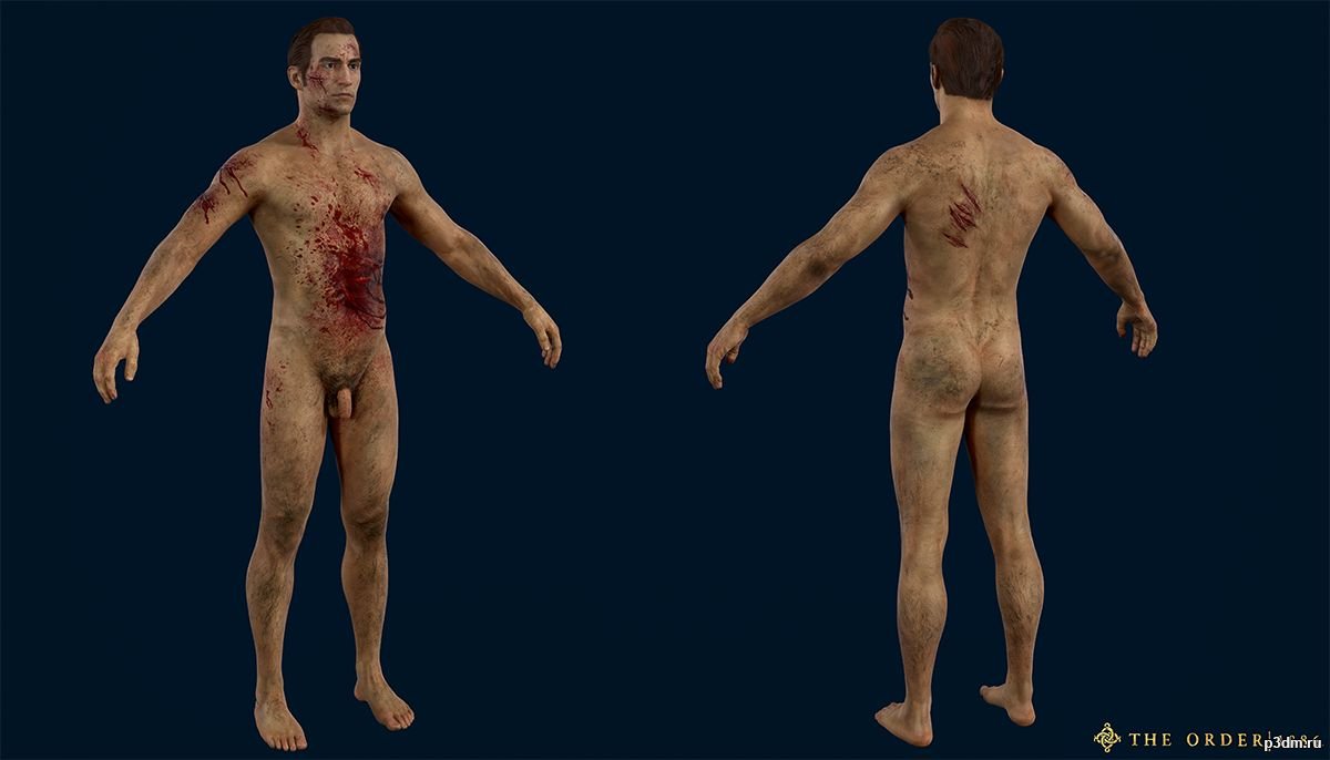 Alastair D’Argyll Injured 3D Model